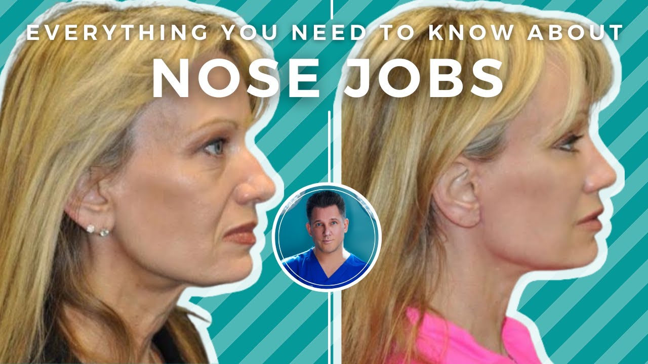 How Much Is a Nose Job? A Complete Cost Breakdown